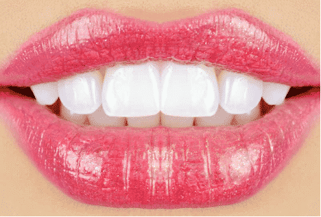 teeth whitening in beaconsfield
